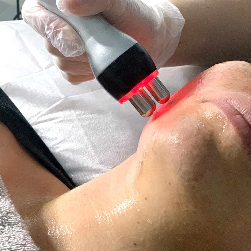 perth facial