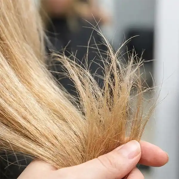 Advanced scalp analysis and hair loss treatment by a Trichologist in Perth.