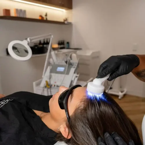 Advanced scalp analysis and hair loss treatment by a Trichologist in Perth.